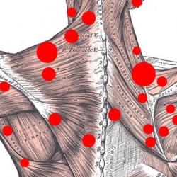 massagem dos pontos de gatilho